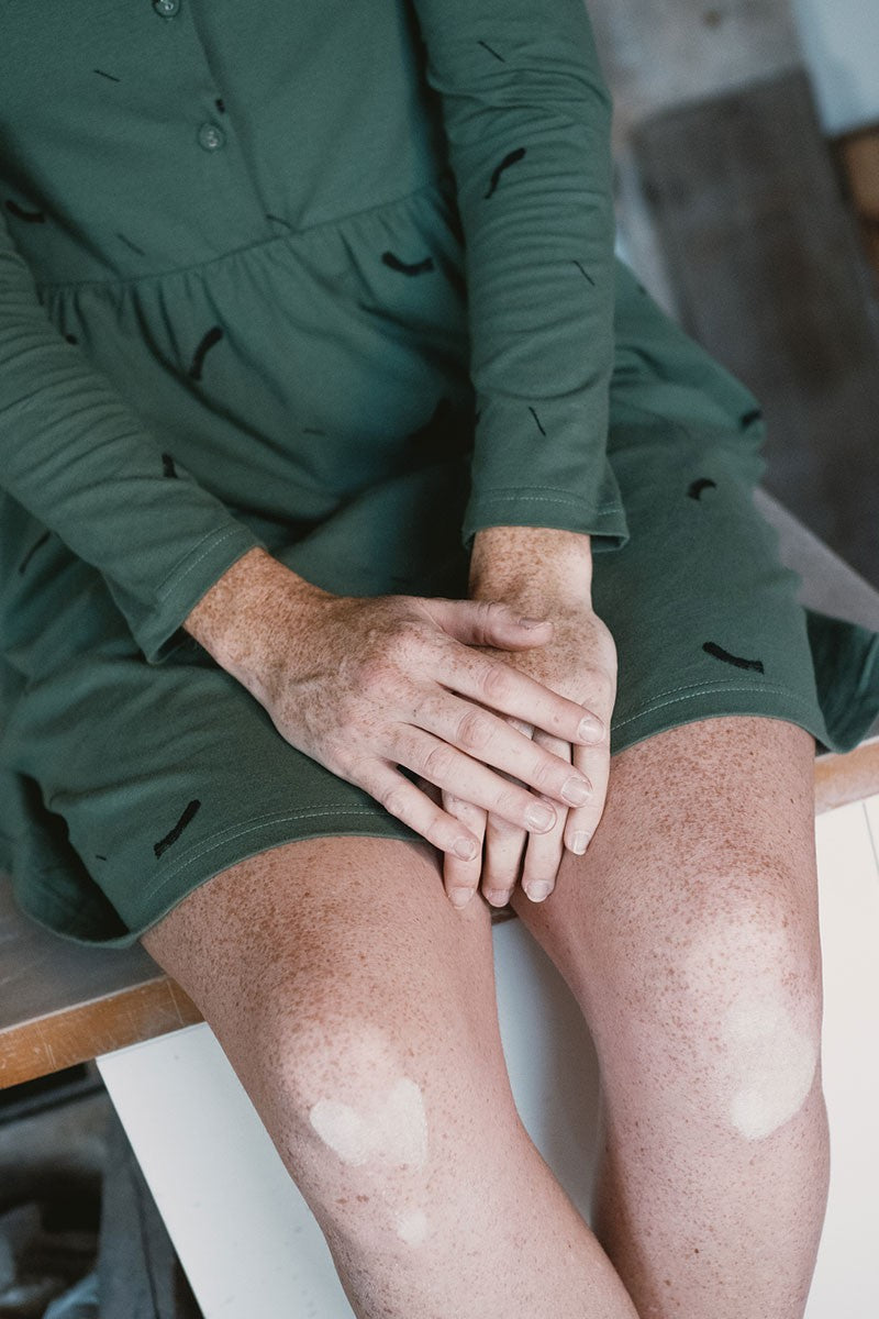 June Raglan Sleeve Dress Strokes Green